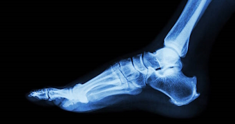 X-ray normal foot lateral